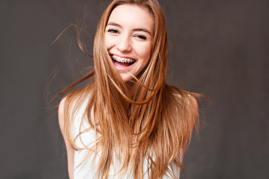 брекеты фото