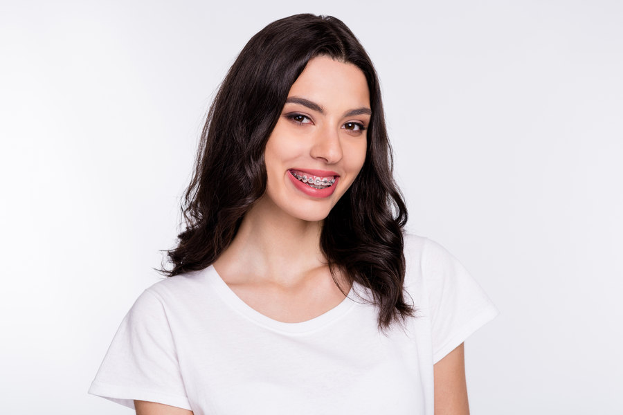 брекеты фото