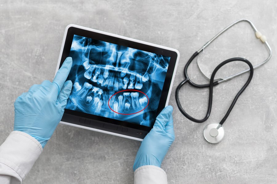 хирургическая стоматология фото