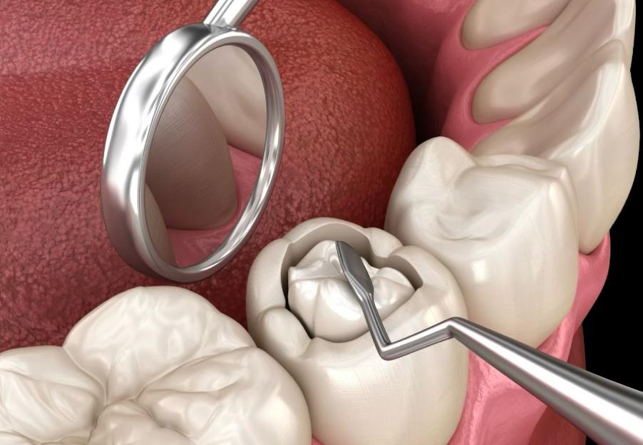 показания к установке имплантов на передние зубы