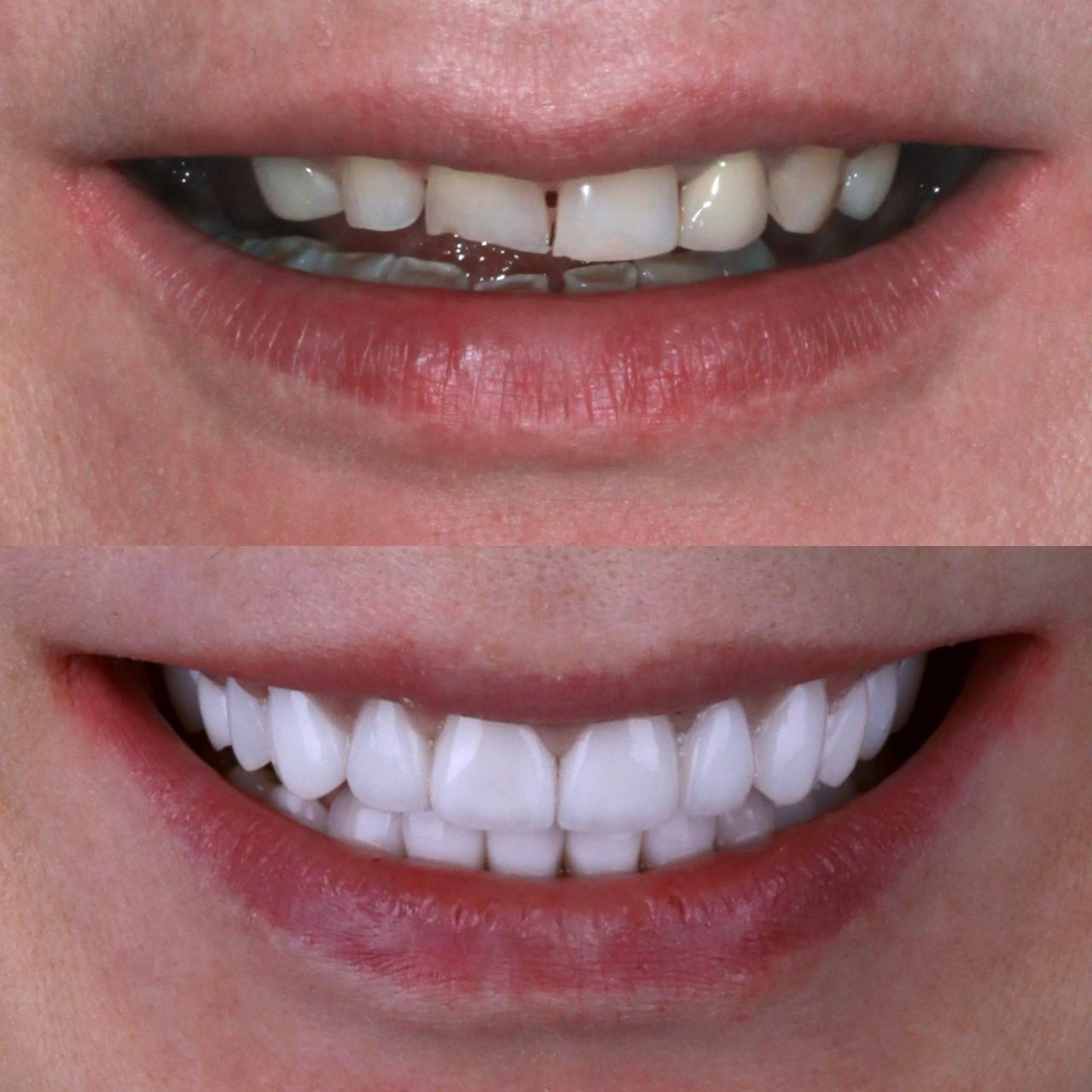 фото-пример лечения зубов под микроскопом 1