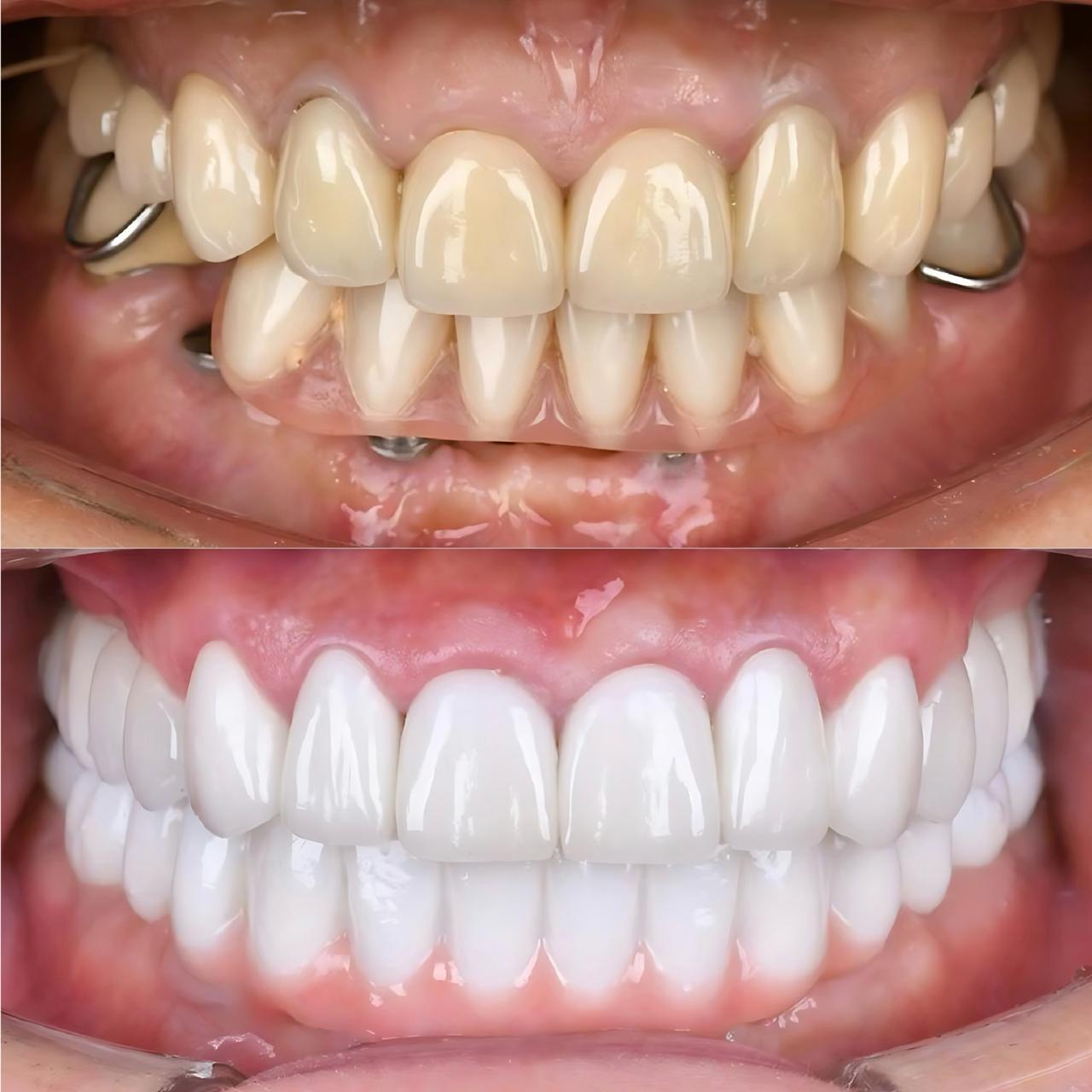 фото-пример лечения зубов под микроскопом 2