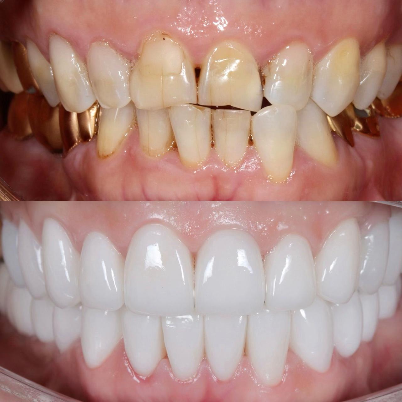 фото-пример лечения зубов под микроскопом 5