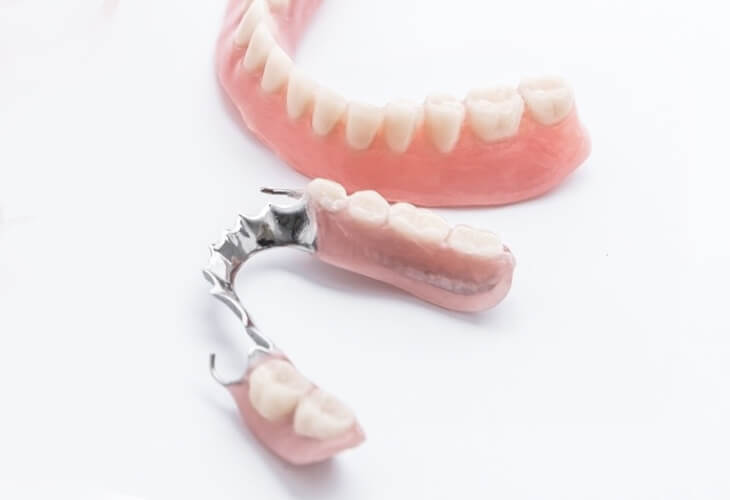 съемный пластиночный протез