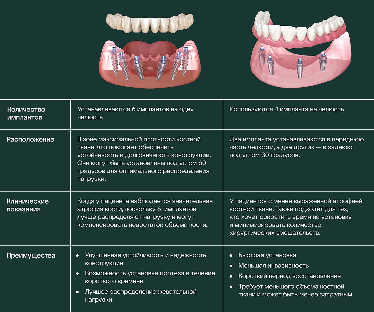 Сравнение методик имплантации - 1