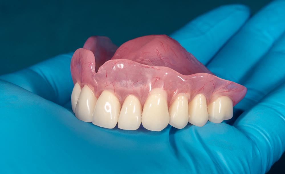 Съемные протезы с нёбом - 1