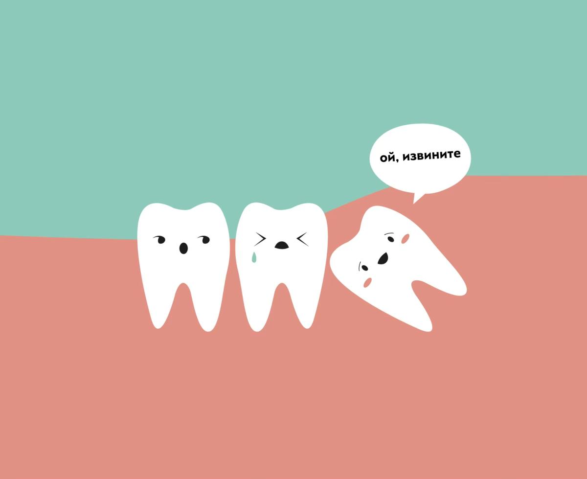 зуб который не может вылезти